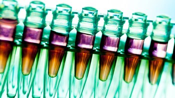 El acuerdo entre el laboratorio