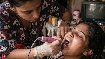 Familia recurre a máquina de uñas para atender urgencia odontológica de una menor en Cuba por falta de insumos en la isla