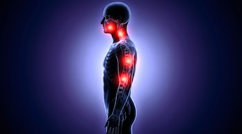 Silueta lateral de un cuerpo humano con esqueleto visible. Zonas rojas brillantes en la mandíbula, cuello y espalda destacan puntos de dolor o inflamación.
