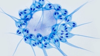 Un grupo de científicos encontró