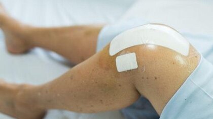 Pros y contras de la cirugía robótica de reemplazo de rodilla