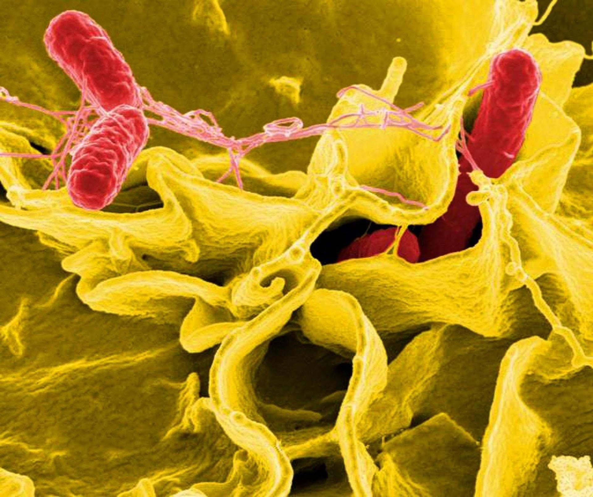 La pesquisa federal por salmonella ya suma cientos de casos y decenas de internaciones en distintos puntos del país (NIAID)