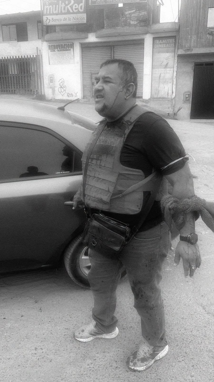 El policía recibió impactos de bala en el mentón y el brazo izquierdo. Facebook: José Antonio Palacios Obregón