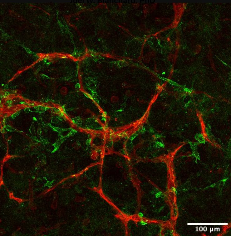 El equipo científico analiza el impacto de la variante genética APOE4 para identificar biomarcadores de daño celular vinculados al alzhéimer (@JoelWBlanchard)