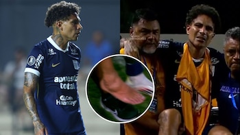 Paolo Guerrero se lesionó del