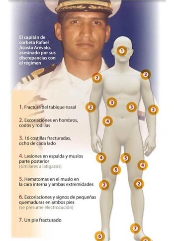 El capitán Acosta Arévalo, torturado