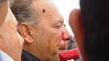 Berni General Paz Agresion