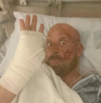 Tras su terrible accidente Jonathan