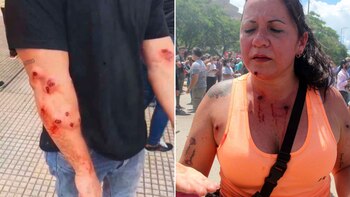 Personas heridas por la represión