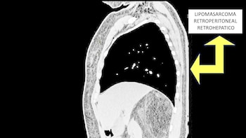 Imagen 4NCGMCTBOZF3FPTJYR6STE3YRU