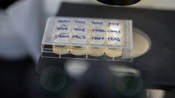 De animales a personas: según un estudio, podría haber 7.000 tipos de coronavirus