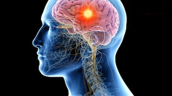 Por qué los problemas de