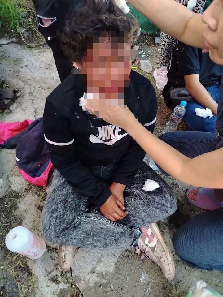 Explosión pirotecnia Tepojaco Cuautitlán Izcalli Edomex