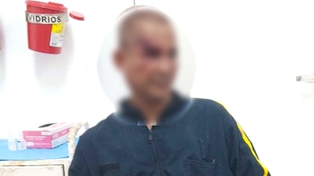 Brutal agresión contra un vigilante