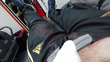 El herido fue trasladado al