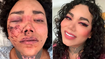 La influencer fue golpeada por