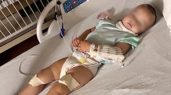 Un bebé con el rostro borroso yace en una cama de hospital con una pulsera identificativa, tubos, vías y vendajes.