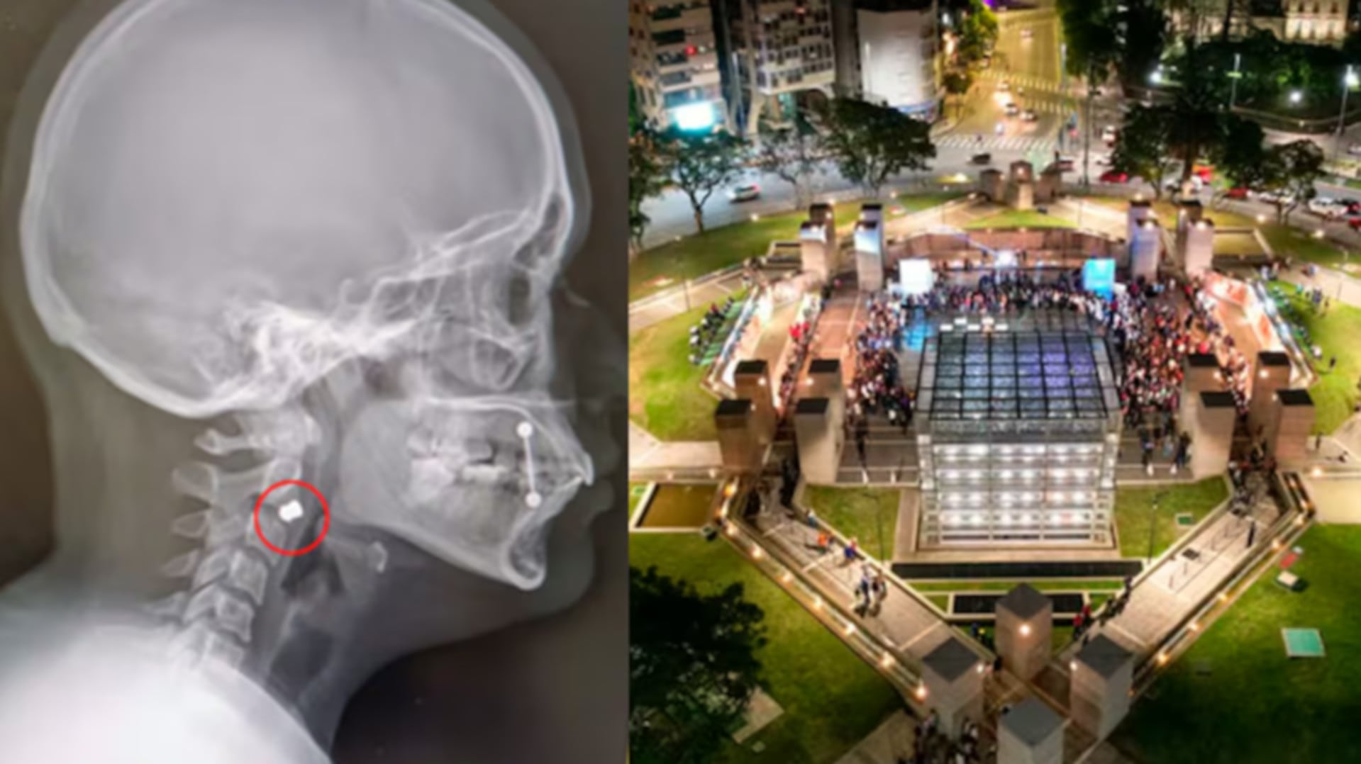 La radiografía muestra un proyectil incrustado en la cabeza de una víctima tras el ataque con tiros de aire comprimido en Plaza España de Córdoba, donde se observa la plaza concurrida de noche (El Doce.tv)