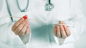 La muestra obtenida deberá a