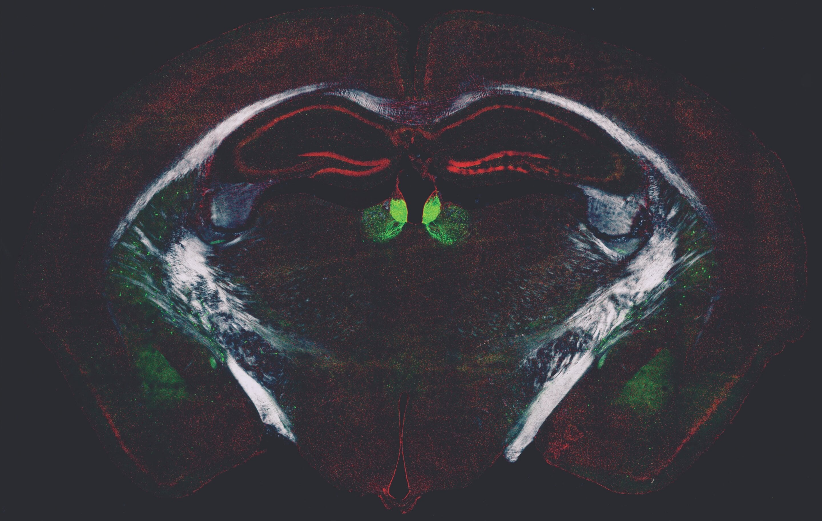 Investigadores de CUNY identificaron un sistema cerebral que regula el aprendizaje y la adaptación en adultos Credit: Andreas H. Kottman (CUNY)