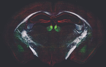 Investigadores de CUNY identificaron un sistema cerebral que regula el aprendizaje y la adaptación en adultos Credit: Andreas H. Kottman (CUNY)