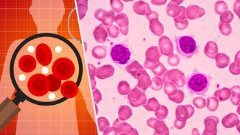 La droga se administra en