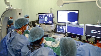 El procedimiento reduce a la