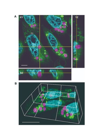 La técnica puede permitir la