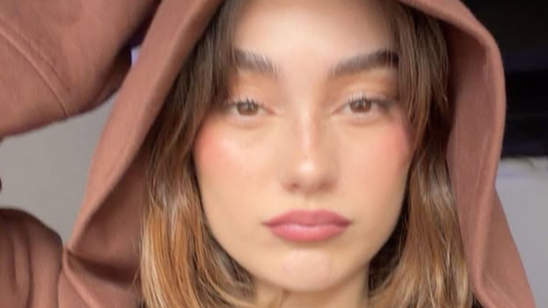 Creadora de contenido reveló detalles del percance que vivió con un procedimiento estético: “Pensé que me estaba dando un derrame”