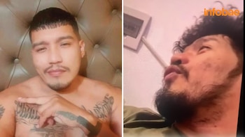 Cambios en nariz y pómulos