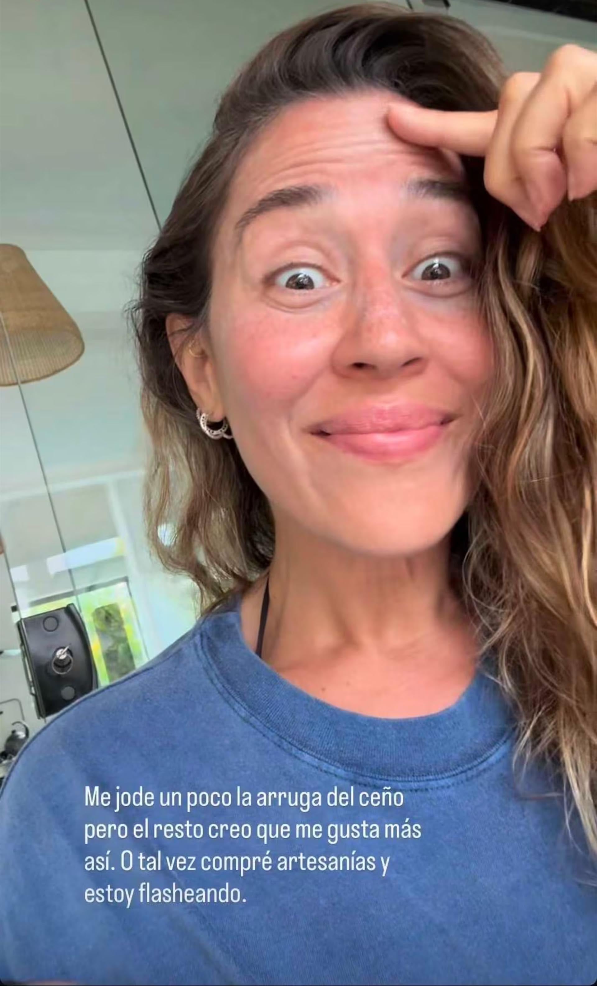 La artista expresó su incomodidad ante las líneas de expresión del entrecejo