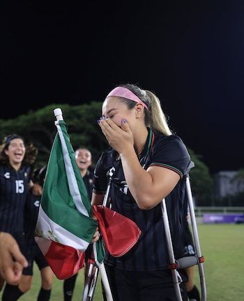 La jugadora del América tiene una lesión parcial de ligamento cruzado
