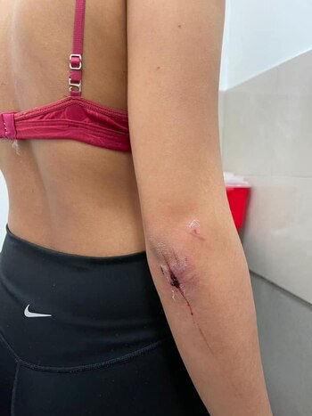 Golpiza: uno de los cortes