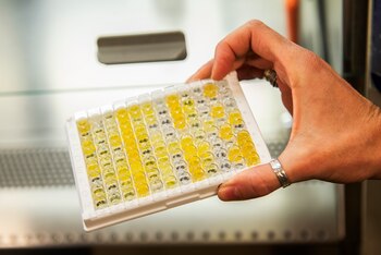 En el estudio se utilizó