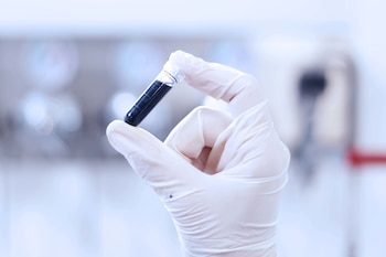 El kit ya está listo