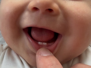 La sonrisa de Dante y sus dos primeros dientes cerraron el álbum digital (Instagram)