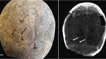 Los análisis toxicológicos en restos
