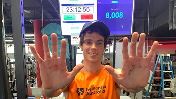 Así quedaron las manos de