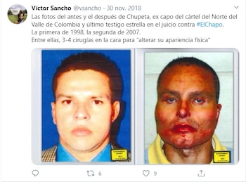 Chupeta- Cirugías-03-10-2020