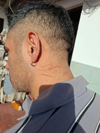 Primer plano de un hombre de perfil, con pelo oscuro y canas, barba, un aro plateado y arañazos rojos en el cuello. Viste un polo gris