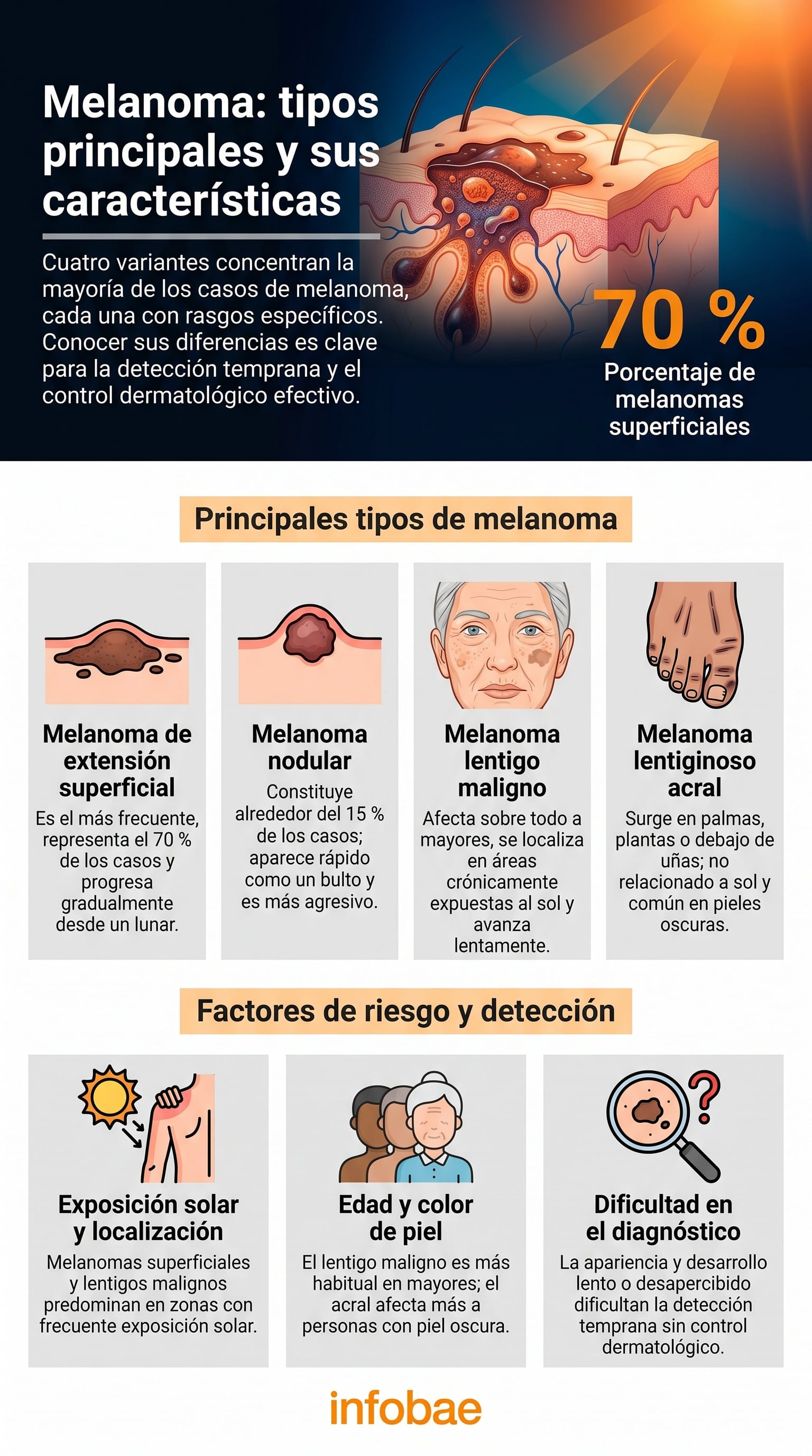 Esta infografía detalla los cuatro principales tipos de melanoma y sus características distintivas, destacando factores de riesgo como la exposición solar y las dificultades en su diagnóstico para una detección temprana. (Imagen Ilustrativa Infobae)