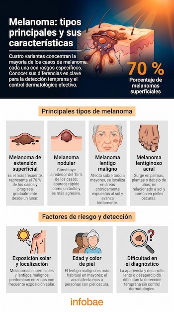 Infografía mostrando los tipos de melanoma: superficial, nodular, lentigo maligno y acral, con ilustraciones de piel, cara, pie, sol y lupa; destaca riesgos y detección.