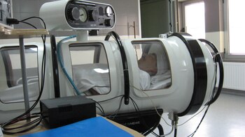 Tras el inicio de la