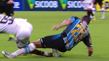 La escalofriante fractura de tobillo