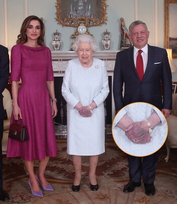 En 2019, el hematoma en