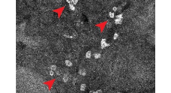 La técnica permitió observar la