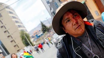 Un manifestante herido en La