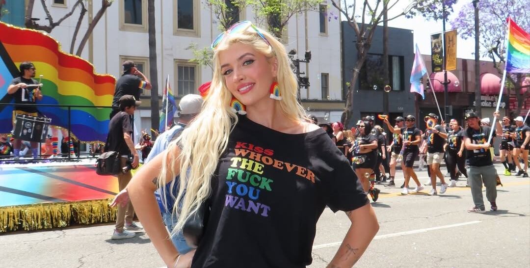 Sami Sheen admitió que el procedimiento más doloroso que se realizó fueron las carillas. (Instagram/Sami Sheen)