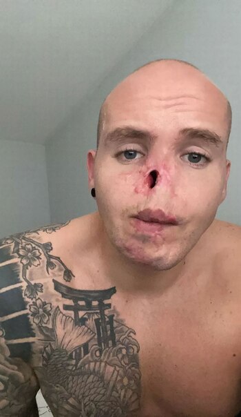 hombre atacado por perros