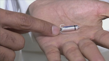 Primer plano de una mano sosteniendo el marcapasos Micra de Medtronic, un pequeño dispositivo cilíndrico plateado con dos ganchos diminutos en un extremo